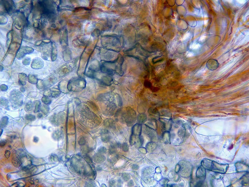 Cheilymenia laevispora 10 - Pelos agua x 400-002